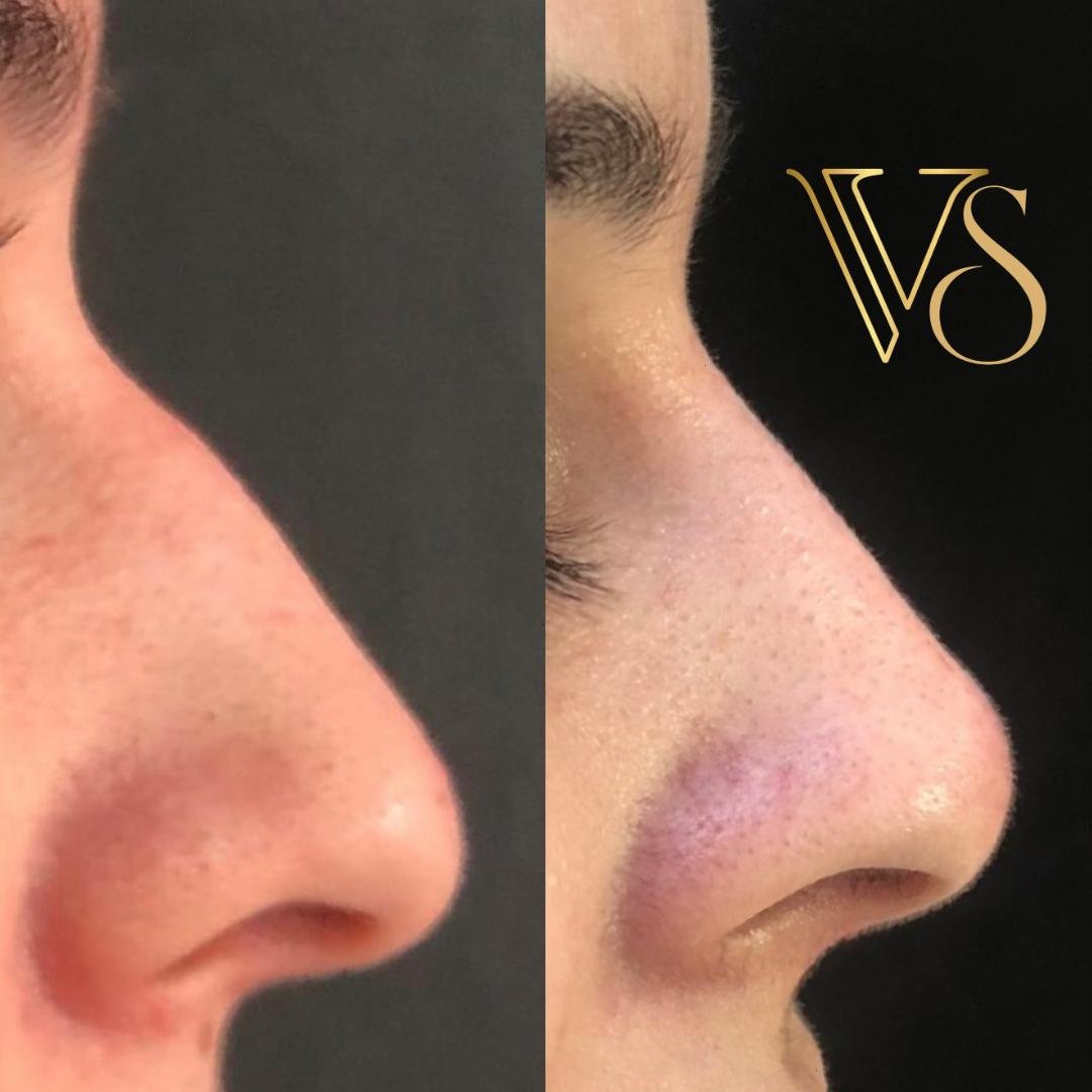 Rinomodelação Dra Vanessa Silveira Castro e Ponta Grossa