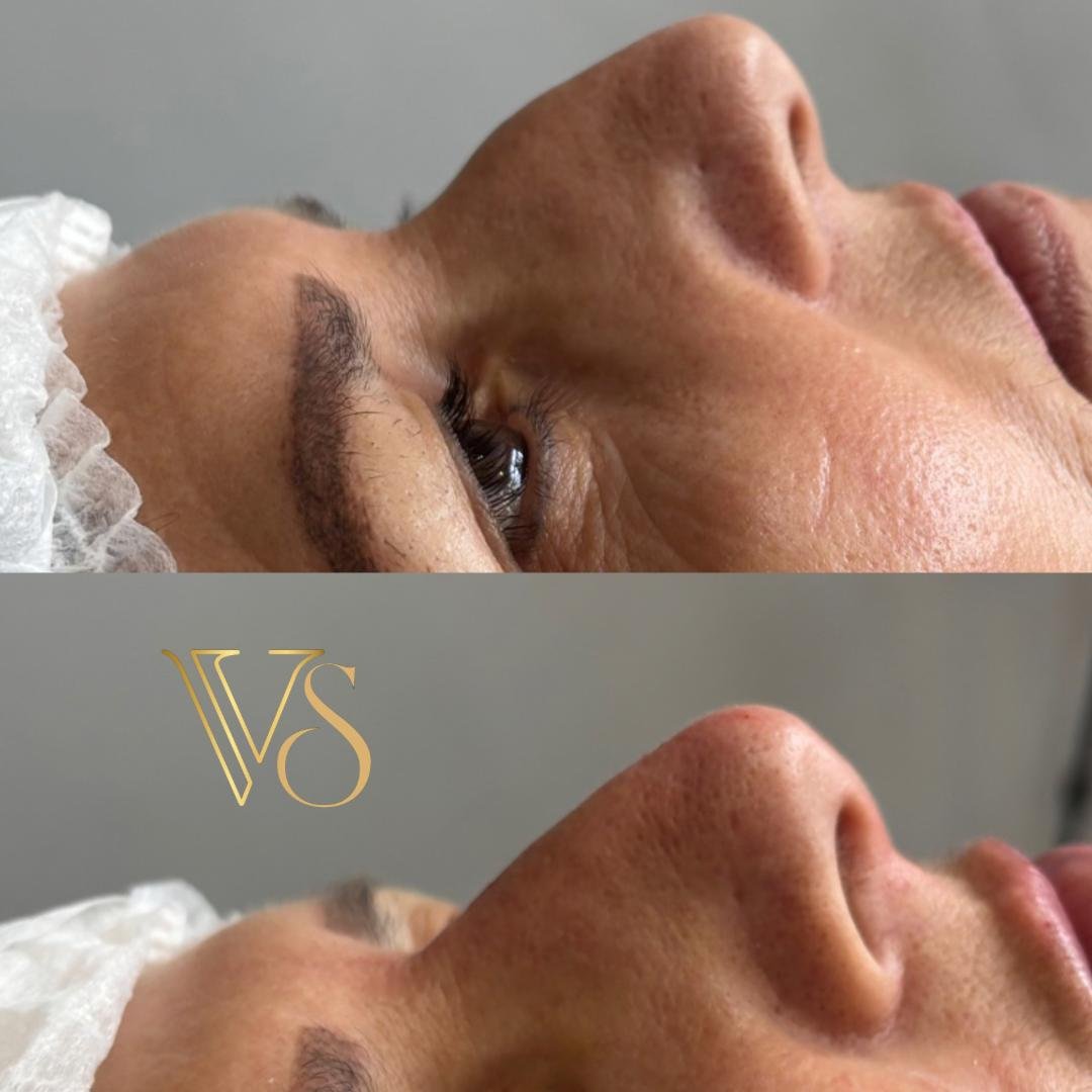 Rinomodelação Dra Vanessa Silveira Castro e Ponta Grossa