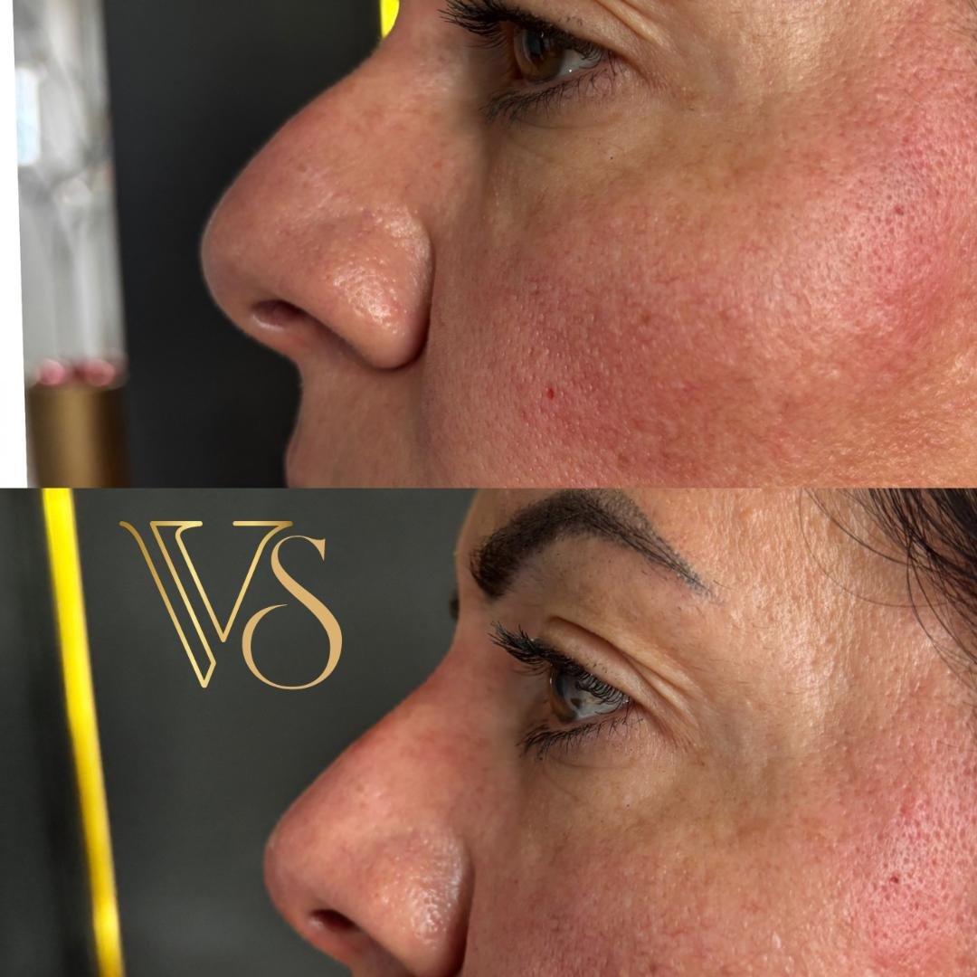 Rinomodelação Dra Vanessa Silveira Castro e Ponta Grossa