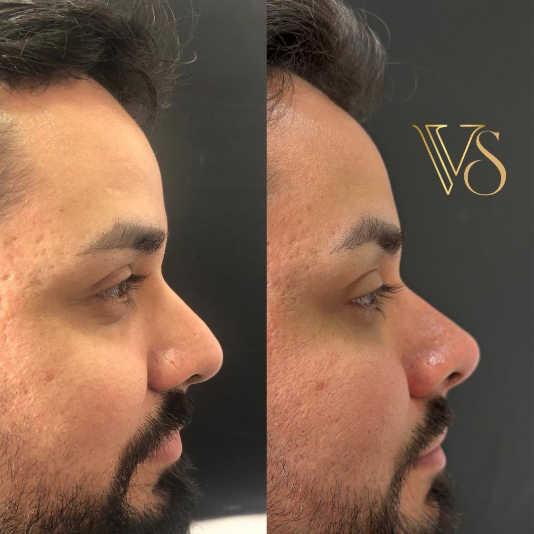 Rinomodelação Dra Vanessa Silveira Castro e Ponta Grossa