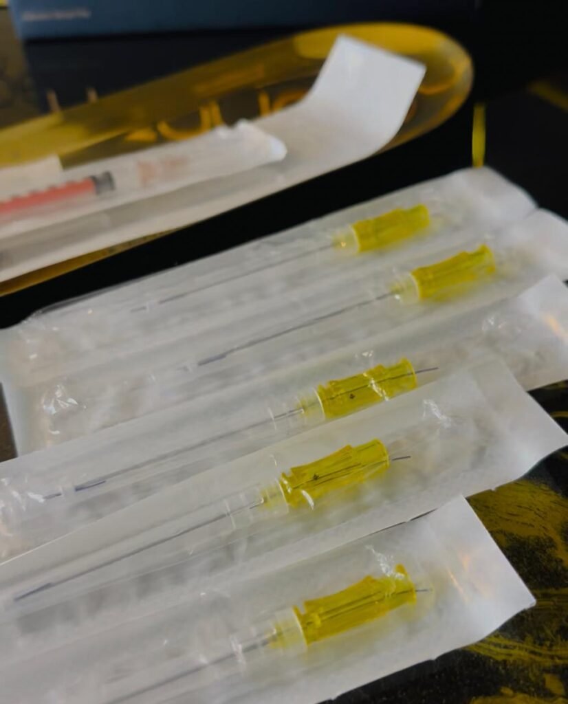 Lifting facial com fios