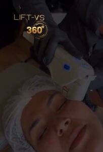 Tratamento para rerverter Ozempic face - Dra Vanessa Silveira LIFT VS 360