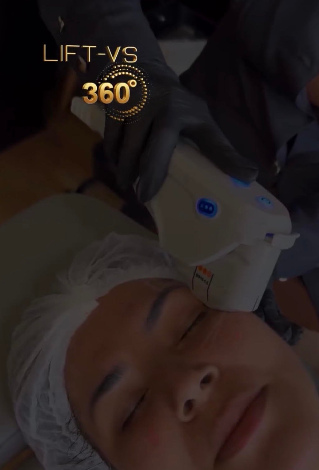 Tratamento para rerverter Ozempic face - Dra Vanessa Silveira LIFT VS 360